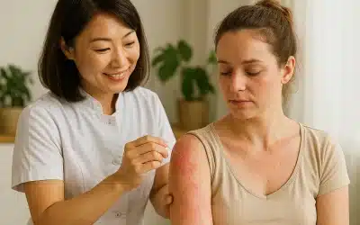 L’eczéma, le psoriasis et les maladies de peau vues par la médecine chinoise